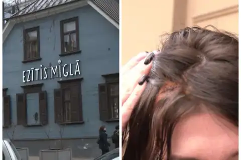 Пять швов на голове «в память» об известном кафе: рижанка в шоке