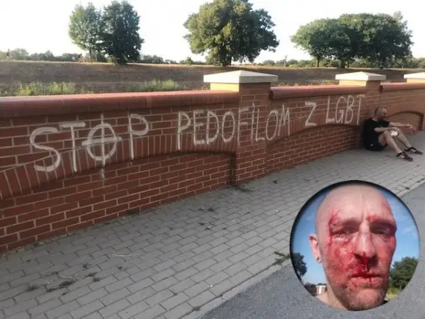 В Польше избили журналиста, возмутившегося надписью «Стоп педофилам с ЛГБТ»