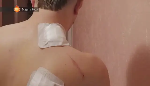 «Ты же полицейский! Я шел к тебе за помощью!» Избитый в Огре мужчина обвиняет полицию