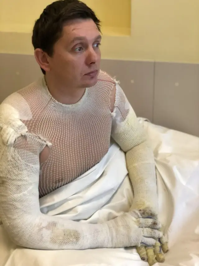Policija atteikusies sākt kriminālprocesu par ugunsgrēku, kurā cieta deputāts Kaimiņš