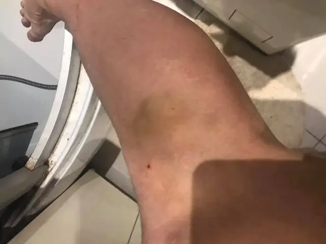 Там же дети гуляют! В Межапарке собака напала на велосипедистку