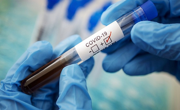 No pilngadīgajiem iedzīvotājiem vakcināciju pret Covid-19 pabeiguši ap 80%, revakcinējušies — ap 27%